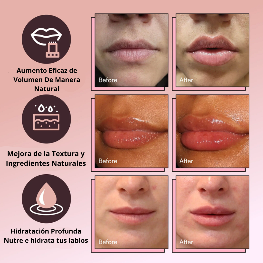 Labios más voluminosos en segundos con DEROL