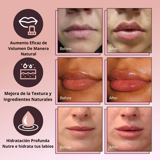 Labios más voluminosos en segundos con DEROL